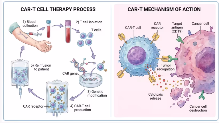 car-t cell therapy